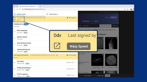 Orbit Discovery Radiology Tutorial - Warp Speed™ button and Signing History