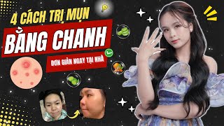 Bạn Sẽ Bất Ngờ Với 4 Cách Trị Mụn Bằng Chanh Ngay Tại Nhà! | Hoàng Ngoan Beauty