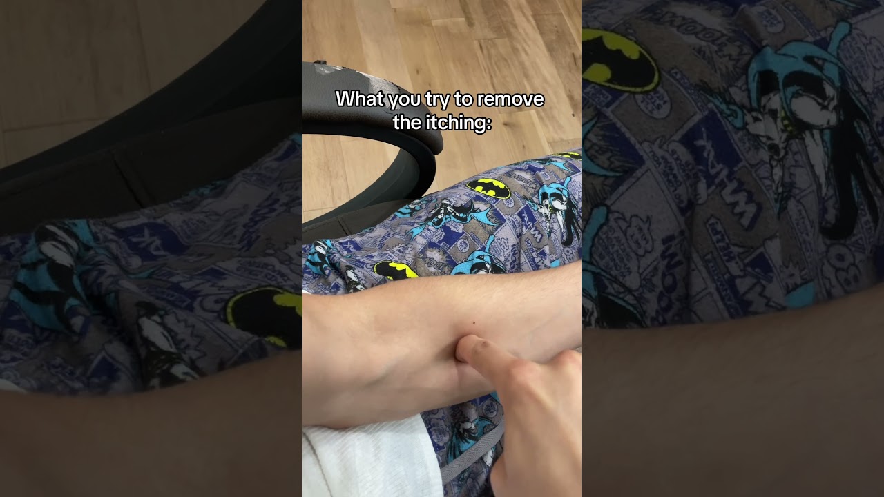 we are talking about mosquitos 💀