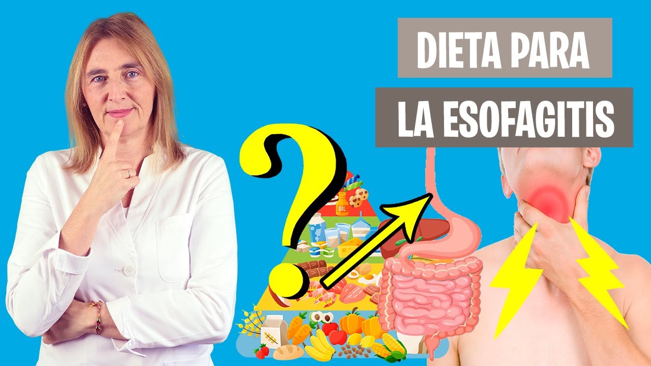 ESTO DEBES COMER si tienes ESOFAGITIS | Los mejores alimentos para la esofagitis | Nutrición clínica