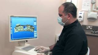 CEREC Treatment at Grandholm Dental Clinic, Aberdeen, Scotland