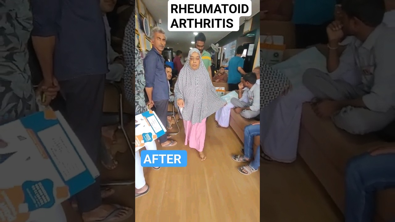 Rheumatoid Arthritis Cure YouTube
