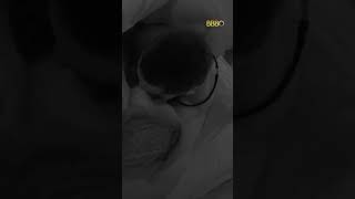 Veio Aí Giovanna E Maike Finalmente Dão O Primeiro Beijo Bbb 25