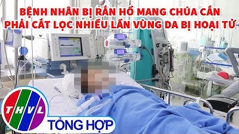 Bệnh nhân bị rắn hổ mang chúa cắn phải cắt lọc nhiều lần vùng da bị hoại tử