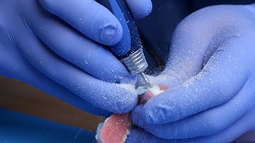 Section B: Passivity | Chapter 1: Cutting "Wells" in the Bite Registration - Smart Denture Conversio