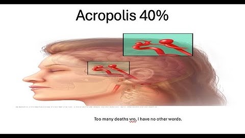 Acropolis 40%