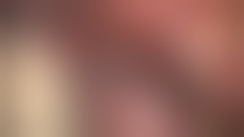 MVD for trigeminal neuralgia caused by venous compression