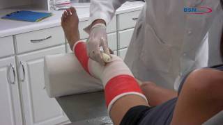 Synthetic casting knee application EN by BSN medical mov Synthetic casting knee application EN by BSN medical mov