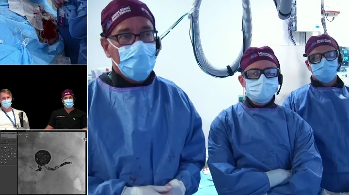 Transradial Coil Embolization of a Large Splenic A...