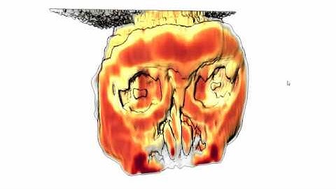 Raycasting MRI T1 of the Monkey Dataset
