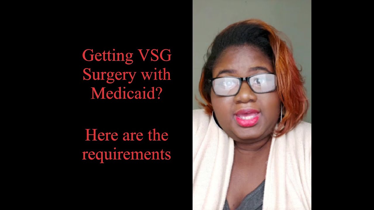 Gastric Sleeve Surgery Requirements Using Medicaid YouTube