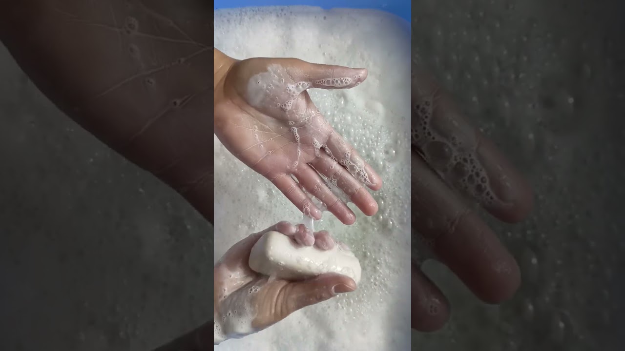 💥💥💥ELSA ,ЕЖК,АИСТ и ОБМЫЛОЧКИ💥💥💥