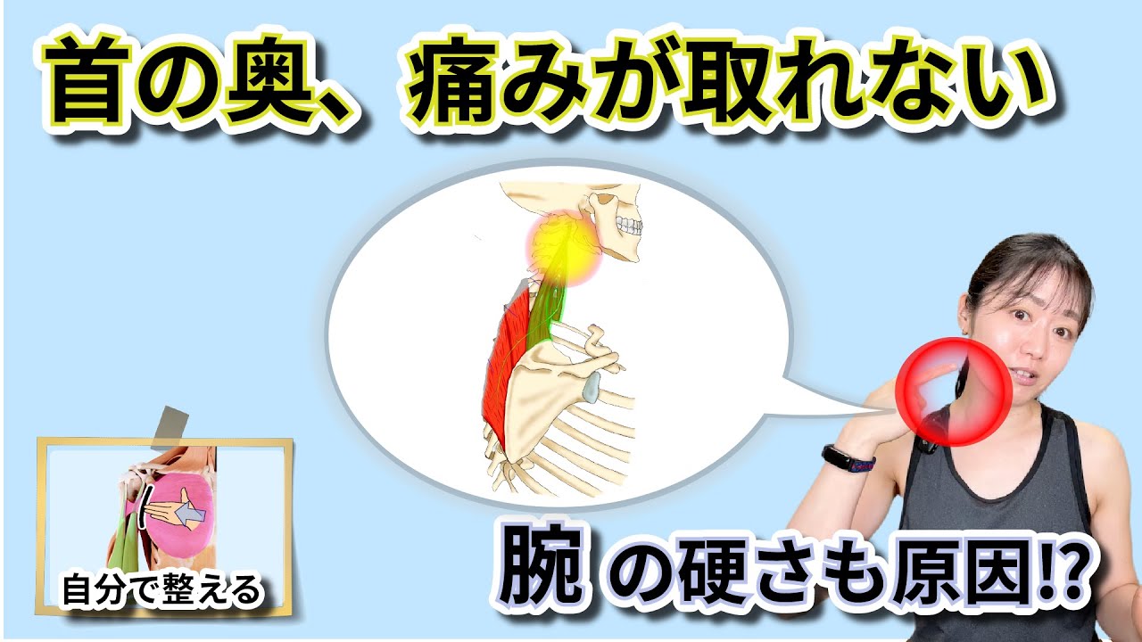 首奥の痛みが取れない⁉︎そんな時は原因を一つ一つ取り除いていくと解消します　 ｜187