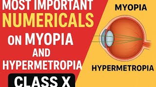 Most Important 🔥🔥 Numericals on Defects of Vision || Myopia || Hypermetropia