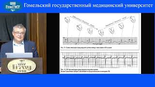 Саливочик Д.П. пассивные эктопические комплексы и ритмы. АВ-диссоциация.