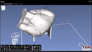 3D Printing A Vascular Tree Model