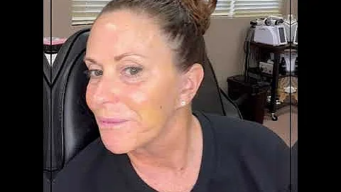 No-Peel Peel To Make Your Skin Youthful And Refreshed