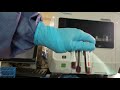 Hematology Performing And Interpreting QC On The Sysmex XN 550 Automated CBC Analyzer 