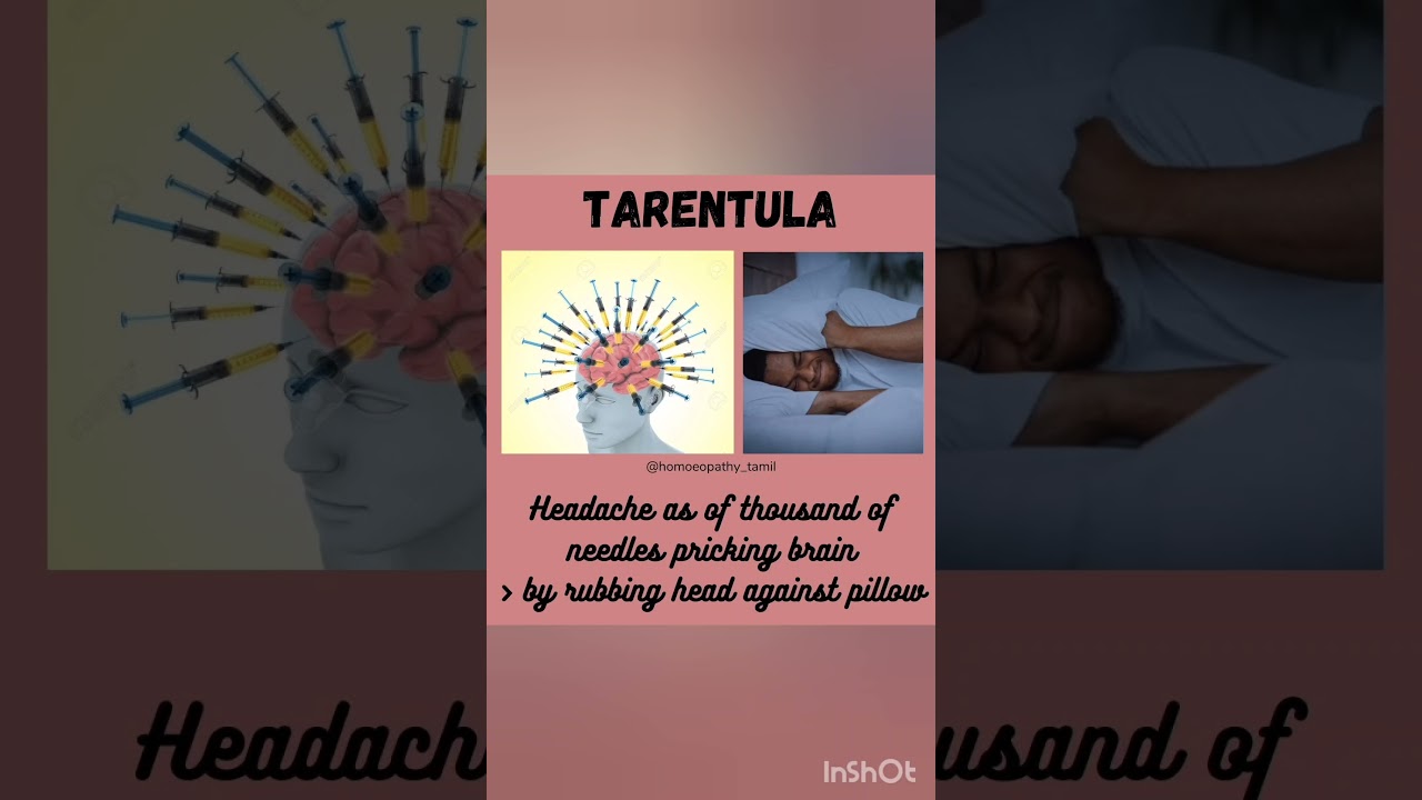 TARENTULA HEADACHE #2marka#3rdbhms#allenskeynote#homoeopathicmedicine