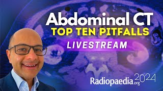 Top ten pitfalls in abdominal CT with Vikas Shah