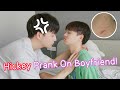 Can My Boyfriend Spot The Fake Hickey On My Neck? Prank | 男友能發現我脖子上的假“草莓”嗎[Gay Couple Lucas&Kibo BL]