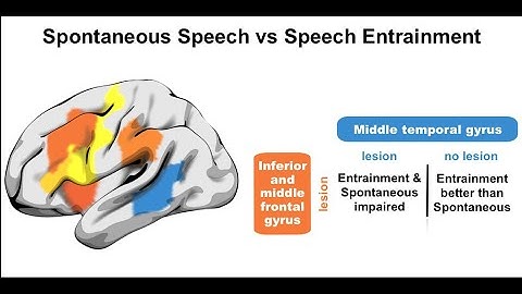 Neural structures supporting spontaneous and assisted (entrained) speech fluency