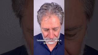 Thinning Hair Solution for Men | Scalp Micropigmentation Las Vegas