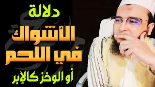 هل تشعر بالوخز كالإبر أو الشوك في اللحم .. لا تستهن بالأمر فإنه سحر الجن !!