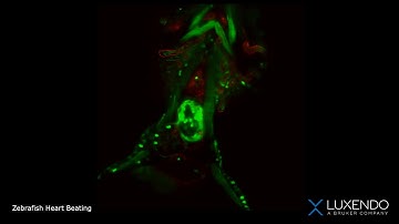 Zebrafish Heart Beating