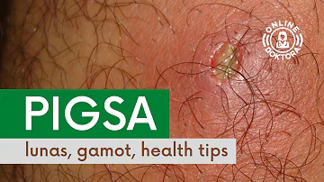 PIGSA: Lunas, Gamot at Health Tips | Anong Dapat Gawin Kapag May Pigsa o Boil?