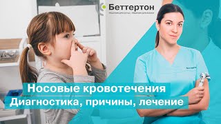 Носовые кровотечения. Диагностика, причины, лечение | Bettertone | Омельченко Ксения Витальевна