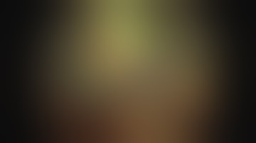 Laparoscopic Cholecystectomy using IMAGE1 S™ Rubina NIR/ICG Technology