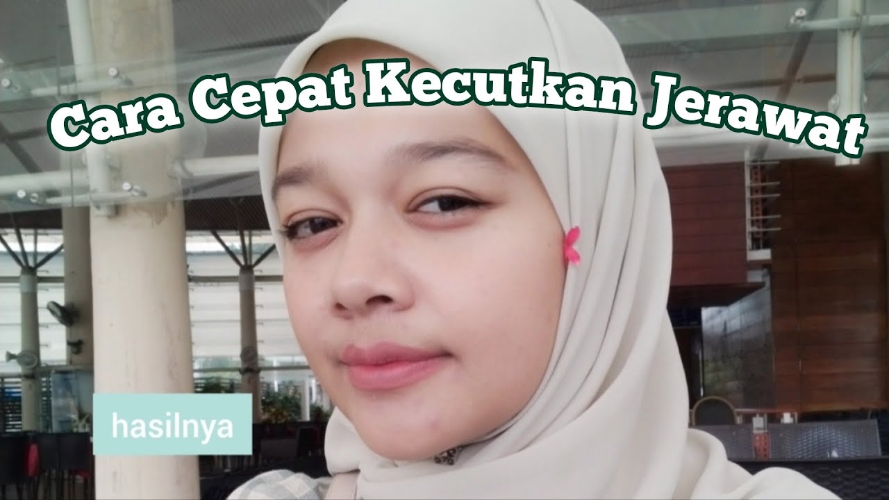 menghilangkan parut jerawat