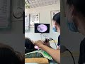 耳垢そうじ/耳が痒くなった鼓膜に付着した軟耳垢/#shorts #short