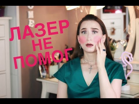 Все о розацеа &#55357;&#56881; Мой опыт лечения мази и БАДы &#55357;&#56485; iHerb