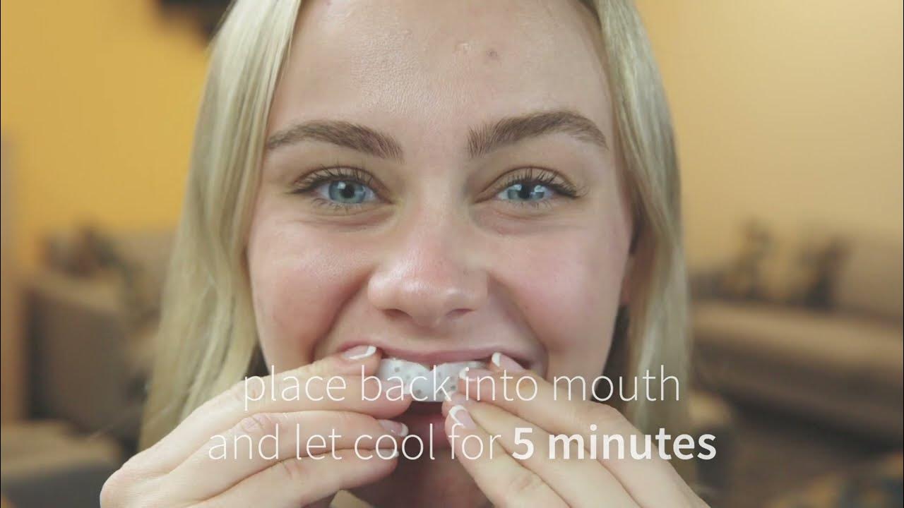 Fitting a Preformed SOVA Night Guard 2022 YouTube