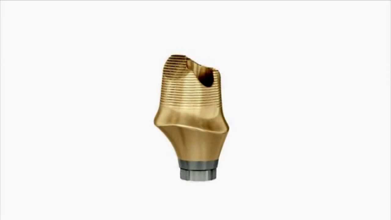 ATLANTIS Abutment the freedom of unlimited possibilities for cement
