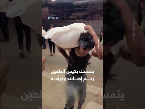 إصابة وجروح لم تمنعه من التمسك بكيس الطحين