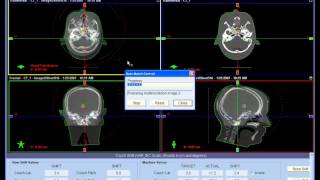 OBI CBCT Process