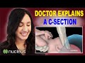 Doctor Uses 3D Animation to Explain C-Section