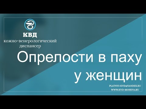 573  Опрелости в паху у женщин