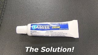 Lamisil At For Women - The Solution 2019