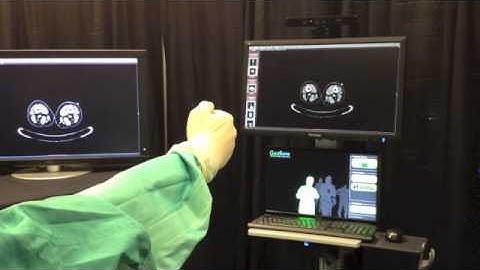 Microsoft Kinect in the 