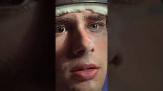 House Md  Dawson Disease 2 house shorts housemd