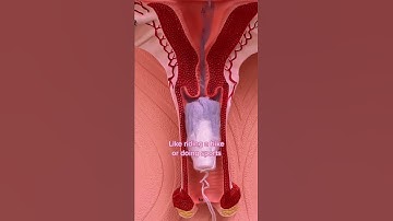 Thumbnail of Can you lose your virginity with a tampon? #shorts