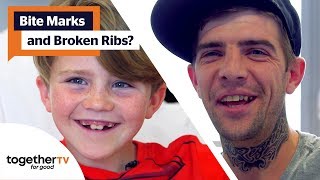 Famous Has Human Bite Marks Patient Suffered Broken Ribs - or Worse? | Secret Life of the Hospital Bed Profile