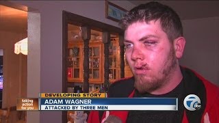 Police search for suspects who beat Army Veteran