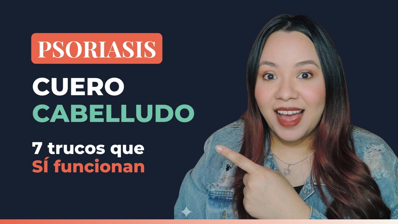PSORIASIS en el cuero cabelludo: cómo distinguirla de la caspa y 7 trucos que me funcionaron