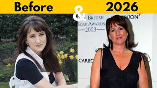 Brookside & EastEnders (Actress) - Before Vs After