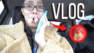 VLOG: I GOT ALL FOUR WISDOM TEETH OUT AT ONCE + One week update + Tips I wish I knew + GIVEAWAY